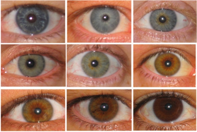 لون العينين هل يرتبط بمشاكل صحية البيان