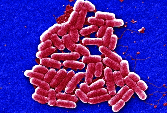 الصورة : ■ سلالة من بكتيريا «إي كولاي»