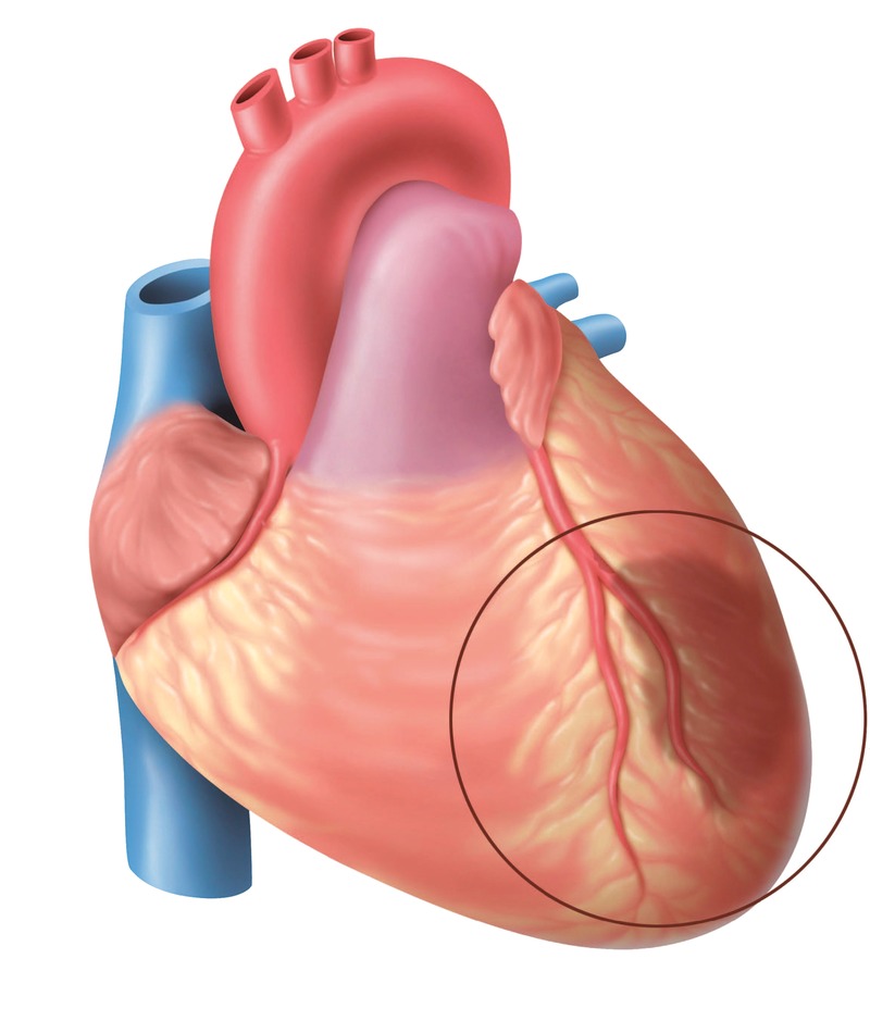 التهابات بطانة القلب تسببها البكتريا والجراثيم البيان