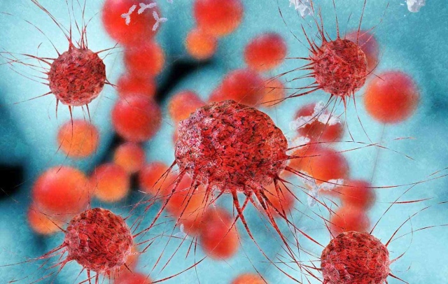 صورة عقار جديد يقتل سرطان الثدي وينهي عصر الجراحة و «الكيماوي» – البيان الصحي – حياة