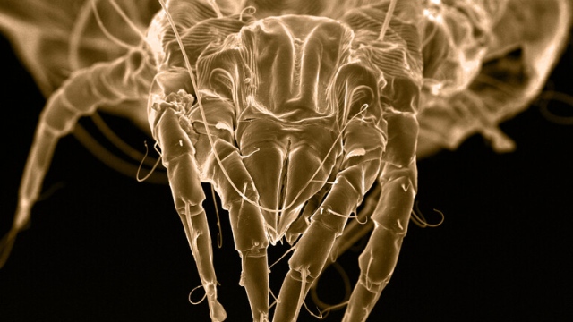 صورة حشرات تعيش في مسام جلدنا وتضع بيضها في وجوهنا! – البيان الصحي