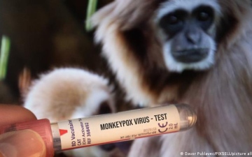 الصورة: الصورة: "الصحة العالمية": لا خوف من تحوّل جدري القردة إلى جائحة "حالياً"
