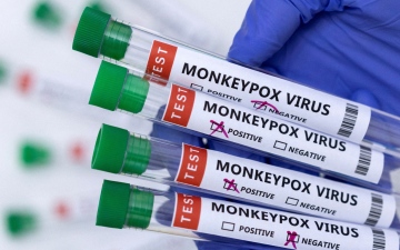 الصورة: الصورة: الاتحاد الأوروبي يوافق على استخدام اللقاح الدنماركي ضد جدري القردة
