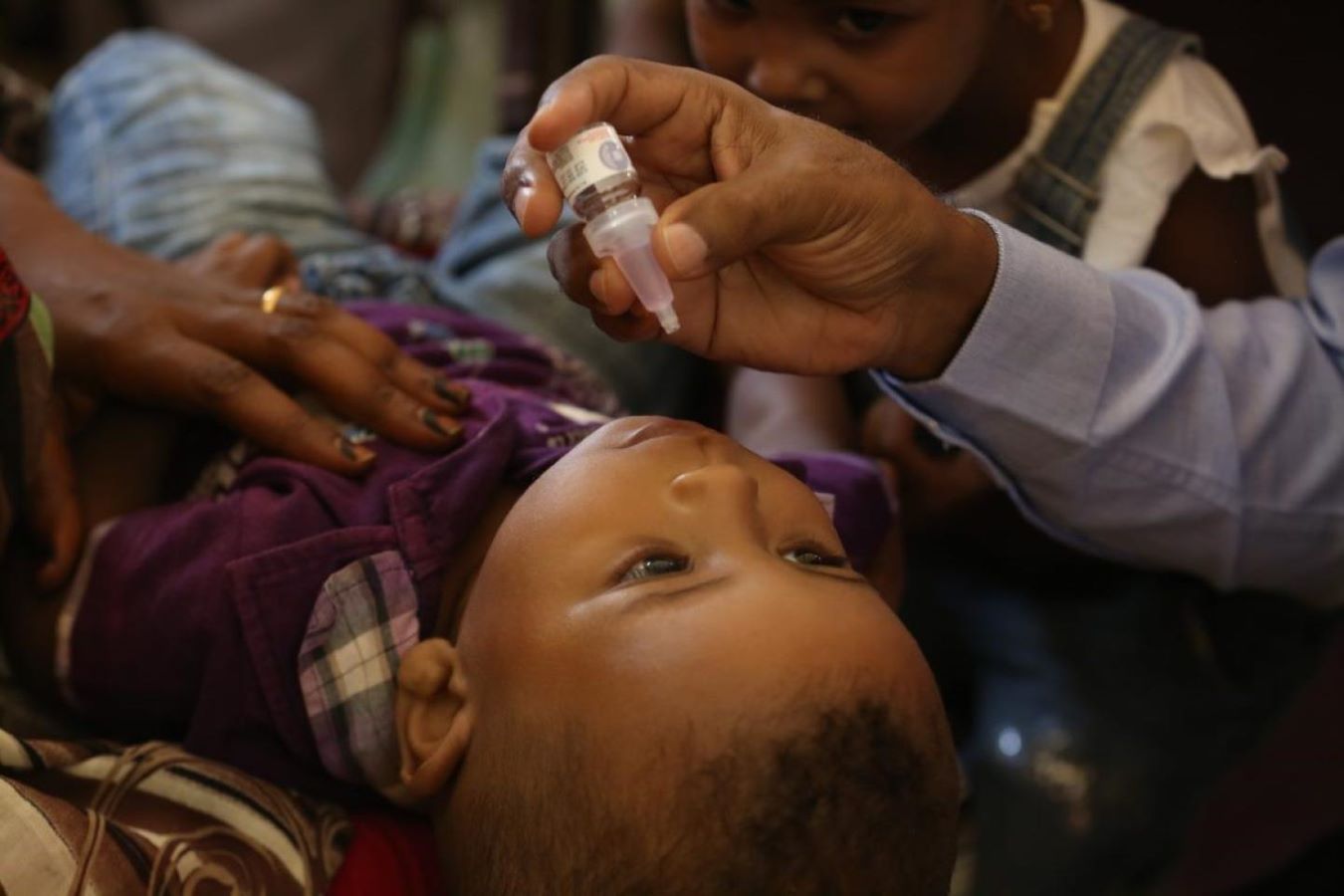 تسجيل إصابة ثانية بشلل الأطفال في السودان
