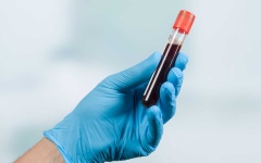 الصورة: الصورة: اختبار دم يكشف 50 نوعاً من السرطان