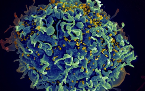 الصورة: الصورة: حالة شفاء جديدة من الإيدز بفضل زرع نخاع عظمي