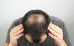 الصورة: الصورة: علاج تساقط الشعر ينقذ الحياة!