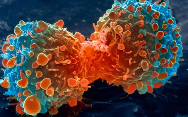 الصورة: الصورة: لقاح واعد لسرطان الرئة يمنع 90 % من الحالات ويكافح المرض المدمر