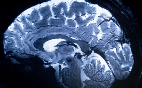 الصورة: الصورة: الصورة الأولى للدماغ البشري يلتقطها أقوى جهاز بالرنين المغناطيسي في العالم