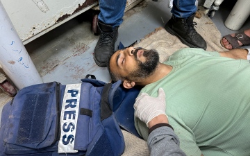 الصورة: الصورة: إصابة صحفي ببتر في ساقه خلال قصف إسرائيلي على غزة